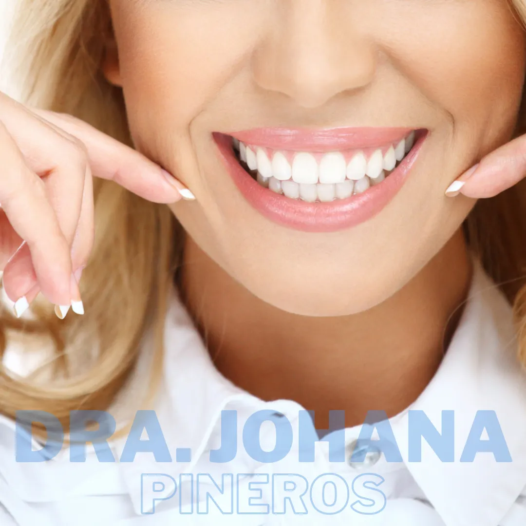 Blanqueamiento dental en Pereira