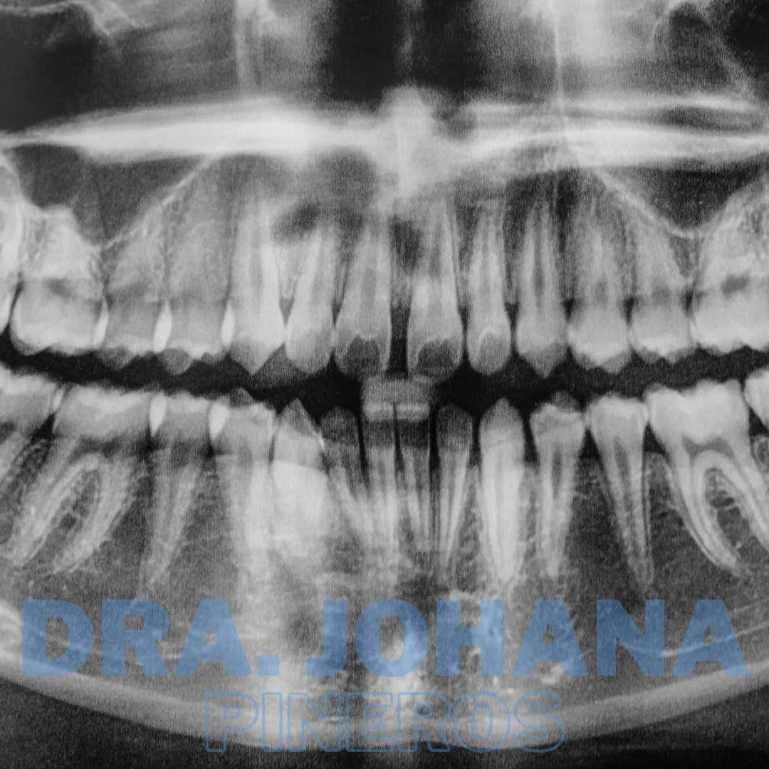 Radiografía panorámica dental en Pereira