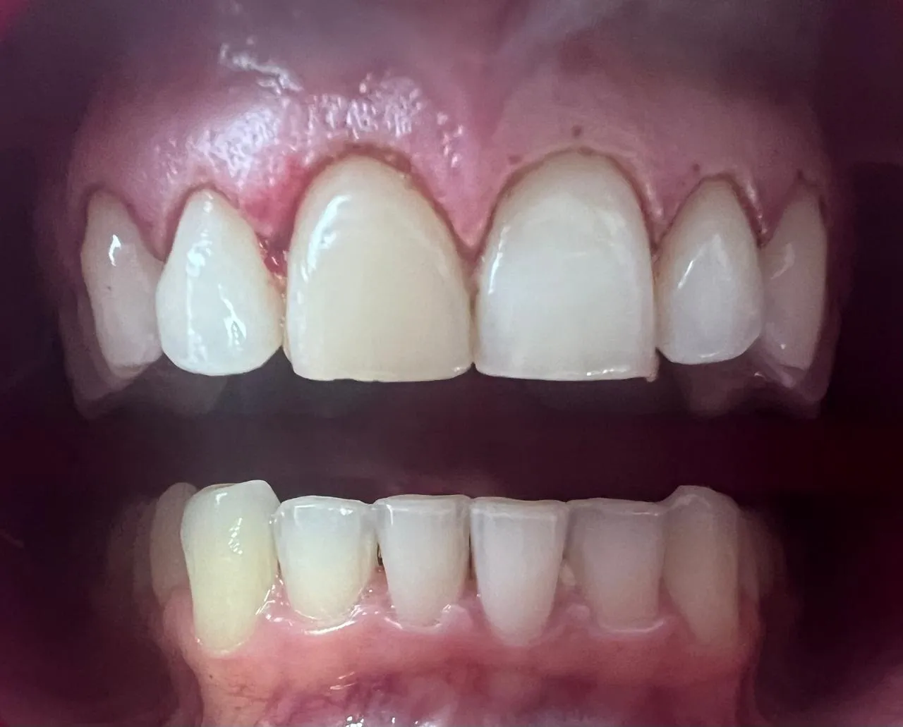 Dentista en Pereira: Guía Completa para Elegir al Profesional Ideal