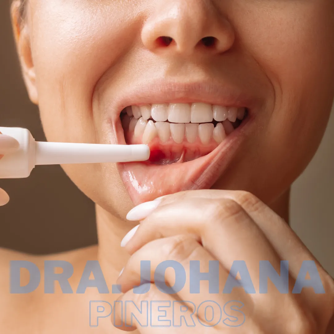 Sangrado de encías al cepillarse los dientes