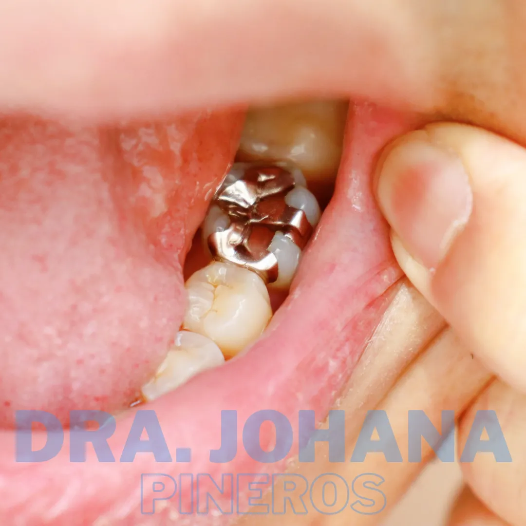 Rehabilitación oral en Pereira